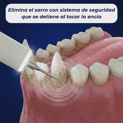LiveSmile™ - Elimina el sarro endurecido de tu perro desde casa en 5 minutos